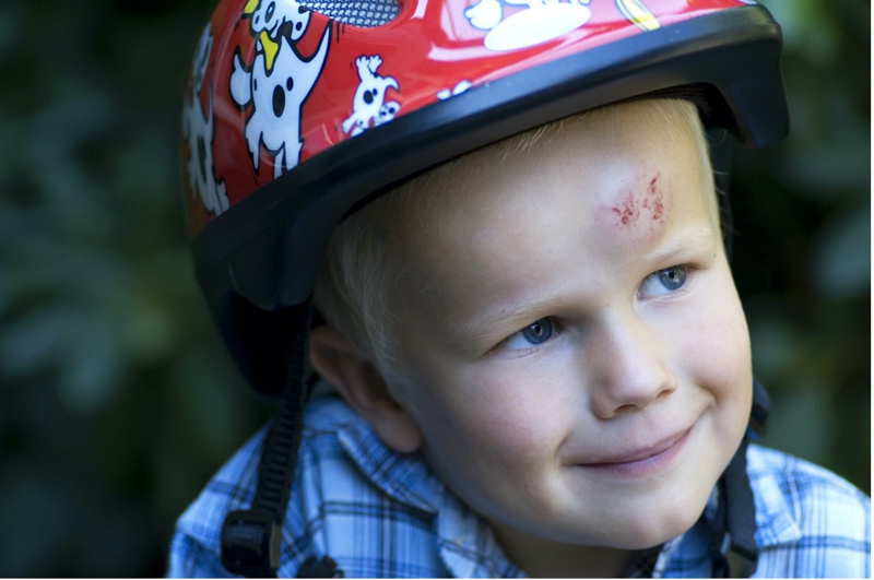 first-aid-training-child-brusied-forehead-min